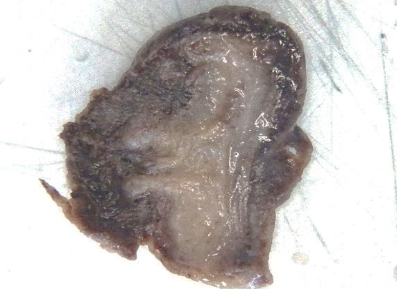 Description of the image